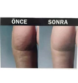 Hema Kadın Anti-Cellulite ( Selülit Giderici ) Masajlı Dikişsiz Paçalı Korse - 11