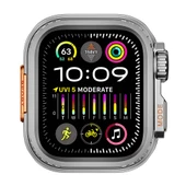 Gpack Apple Watch 44mm Kasa Dönüştürücü ve Ekran Koruyucu Gard 33 - 3