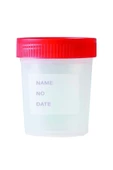 MEDKİMSAN,Numune Kabı 250 Ml | 1 Adet | Steril Poşetli Numune Saklama Kabı - 1