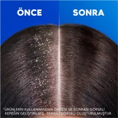 H&S Şampuan Klasik Bakım 2in1 330 Ml - 6