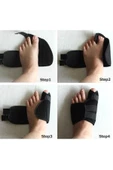 Halluks Valgus Ayak Ateli Ayak Başparmak Kemiği Çıkıntısı Bunyonu Düzeltici - 1