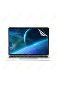 CEPCASE    Macbook Pro 13.3' 2022 M2 A2686 Kılıf Diamond Pırıltılı Kapak Ekran Koruma Klavye Koruma Set - 7