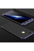 CEPCASE    Xiaomi Mi 5x Kılıf 3 Parça Tam Koruma Zore Ays Kapak - 1