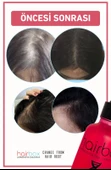 Hairbox Kadın Saç Serumu, Saç Serumu(5'Lİ SERUM ŞAMPUAN ROLLER SAÇ YAĞI) - 4
