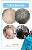 Hairbox Erkek Saç Serumu, Saç Serumu ,  (5 Adet Serum ) - 4