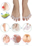Makara Ayak 5 Parmak Ayıran Silikon Bunyon Koruyucu Parmak Ayırıcı Gece Ateli Halluks Valgus thumbnail 1
