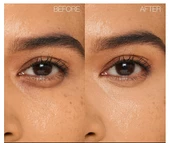 Nars Light Reflecting Eye Brightener Impossible Dream Göz Altı Aydınlatıcı thumbnail 2