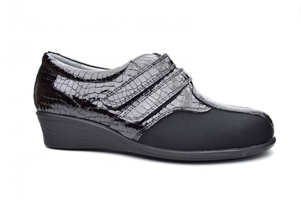 222 Ortopedia Kadın Ayakkabı - Siyah Kroko