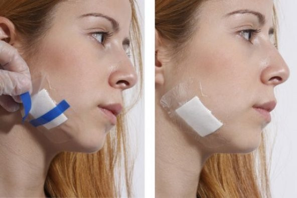 YARA PEDİ ŞEFFAF STERİL ALBAN 10X20 CM 25 ADET ÜCRETSİZ KARGO - 2