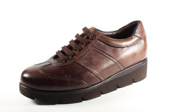 Su Gibi 23190 Vizon Antik Bayan Ayakkabı - 5