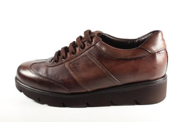 Su Gibi 23190 Vizon Antik Bayan Ayakkabı