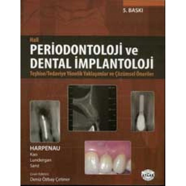 Periodontoloji ve Dental İmplantoloji - Hall