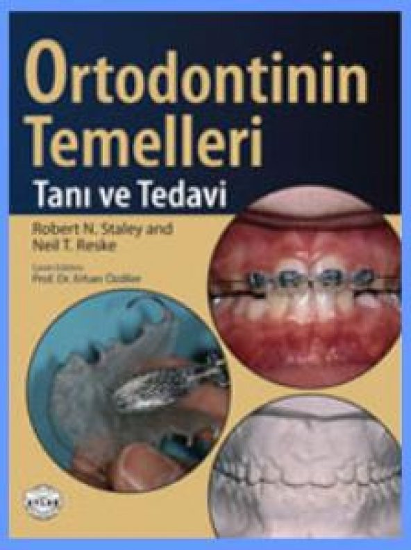 Ortodontinin Temelleri Tanı Ve Tedavi