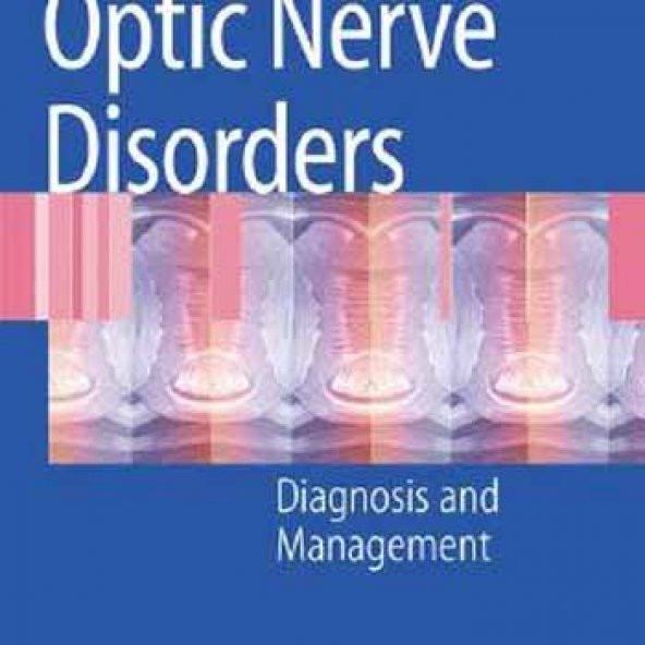 Optic Nerve Disorders Diagnosis And Management