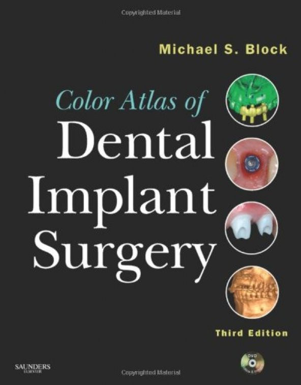 Color Atlas Of Dental Implant Surgery (Book Dvd)
