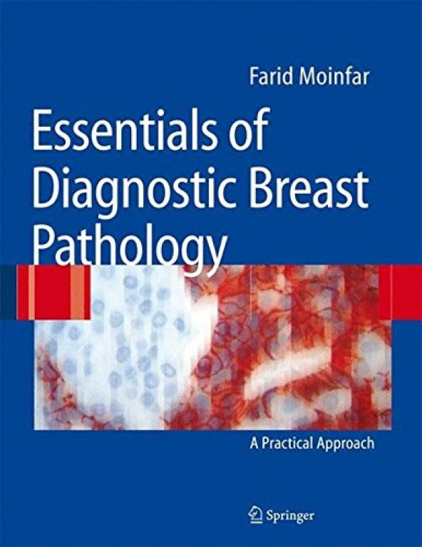 Essentials Of Diagnostic Breast Pathology A Practical Approach