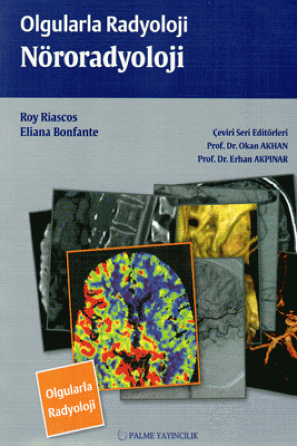 Olgularla Radyoloji Nöroradyoloji Palme Kitabevi