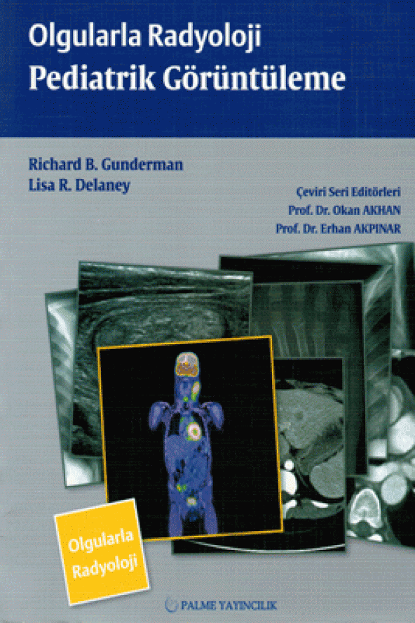 Olgularla Radyoloji Pediatrik Görüntüleme Palme Kitabevi