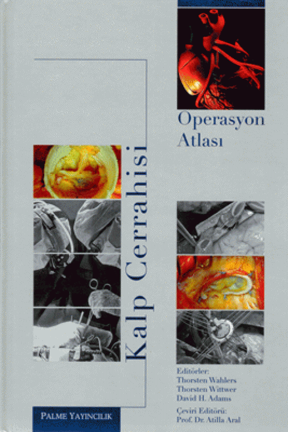 Kalp Cerrahisi - Operasyon Atlası Palme Kitabevi