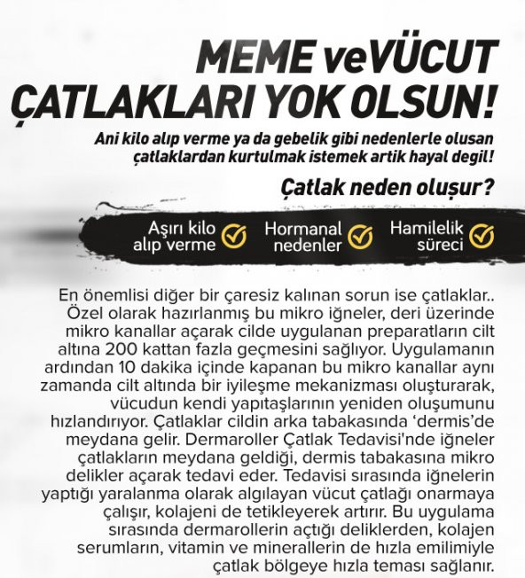 Deluxhair Plus Tinatyum Derma Roller System 540 İğne 0,5 mm 1. Kalite Masaj Aleti RoHs CE Kalite belgeli dermoroller - 3 adet - 9