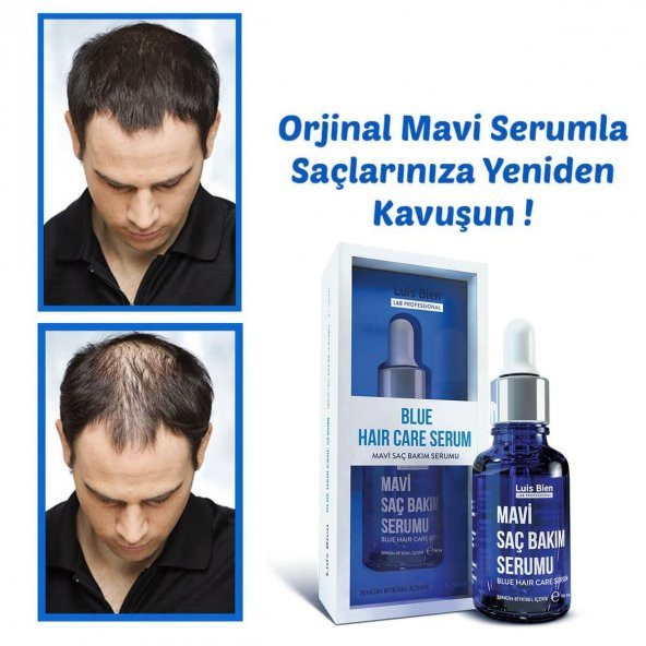 Luis Bien Mavi Saç Losyonu (İksir) 50 ML YENİ ÜRETİM + DERMOROLLER