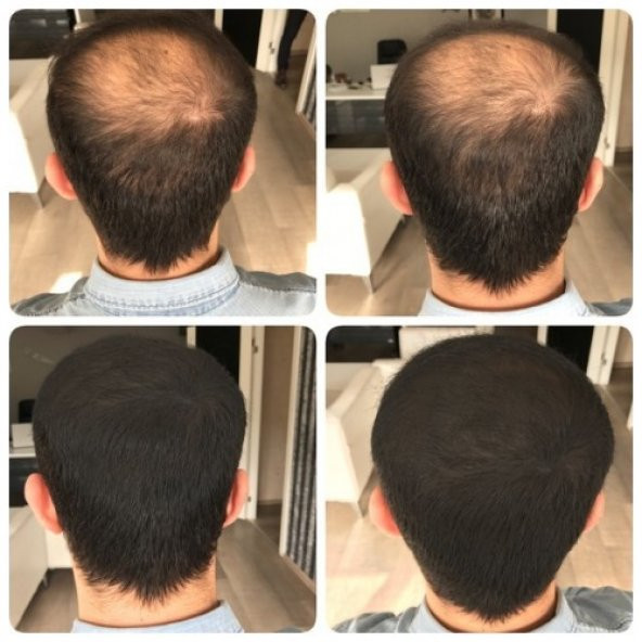 Luis Bien Dolgunlaştırıcı Saç Spreyi Renk: Siyah 100ml - 3