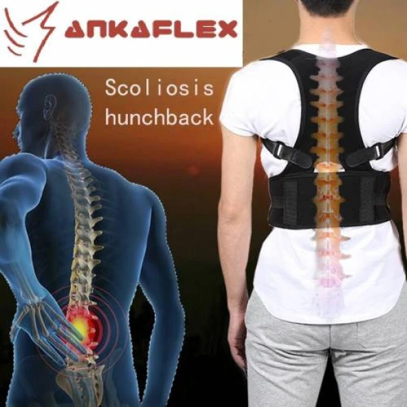 Ankaflex Dik Duruş Korsesi Bel Sırt Korse Kamburluk Önleyici Posturex Hamilelik Sonrası Korsesi - 3