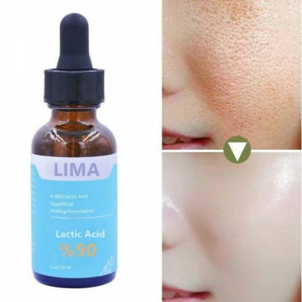 Lima Laktik Asit Serum %90 (Lactic Acid)