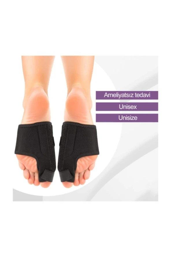 Halluks Valgus Gece Ateli Ayak Bunyon Kemik Koruyucu 1 Çift (sağ Ve Sol)