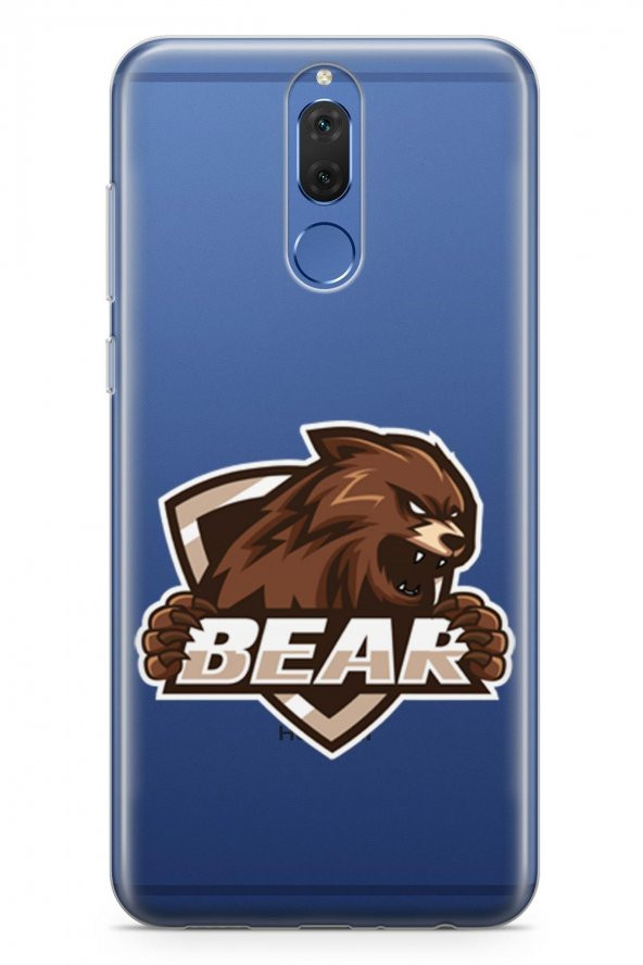 Huawei Nova 2i Kılıf Gamer Oyuncu Serisi Emely - 2