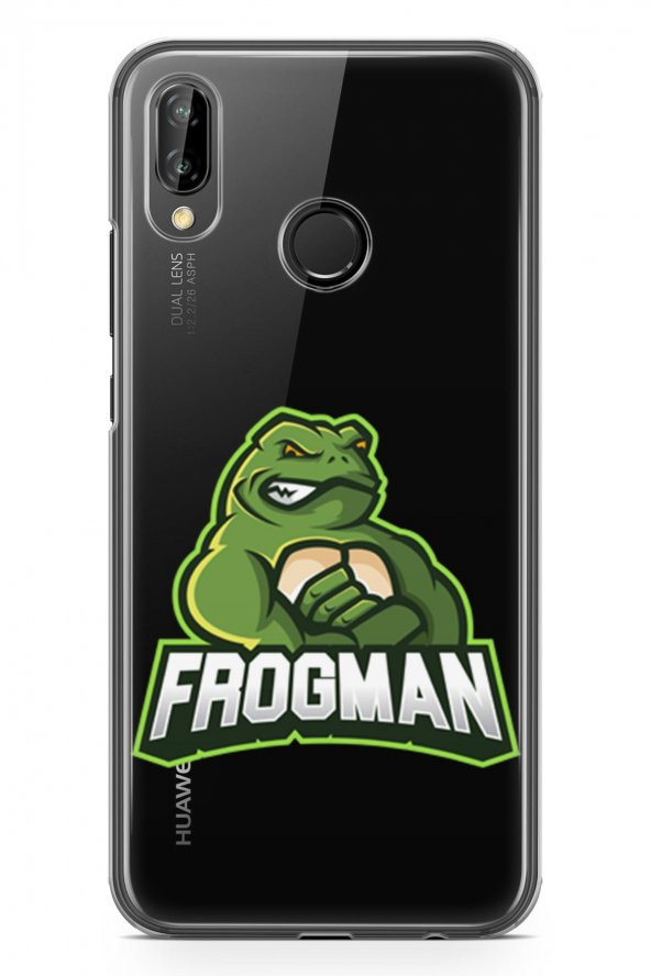 Huawei P20 Lite Kılıf Gamer Oyuncu Serisi Amber - 2
