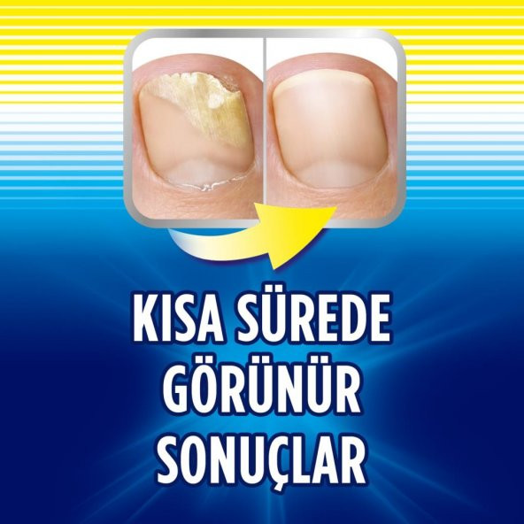 Scholl Tırnak Mantarı Tedavi 3.8 ML - 3