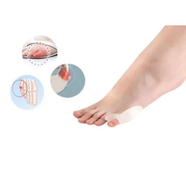 Silikon Makara Ayak Serçe Parmak Yüzük Bunyon Makaralı Koruyucu - 2