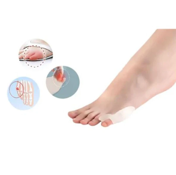 Silikon Makara Ayak Serçe Parmak Yüzük Bunyon Makaralı Koruyucu - 4