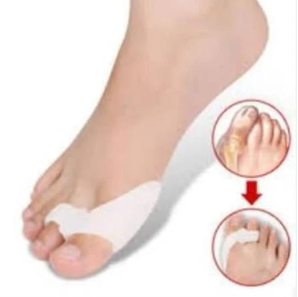 Silikon Makara Ayak Başparmak Ayırıcı Kemik Bunyon Nasır Koruyucu - 2