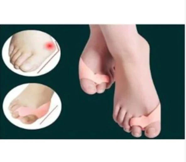 Silikon Makara Ayak Başparmak Ayırıcı Kemik Bunyon Nasır Koruyucu - 6