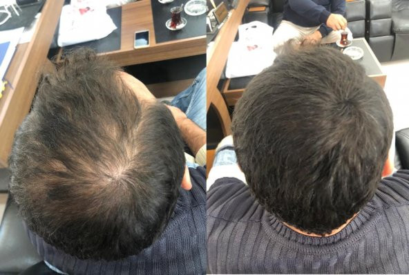 27,5 gr Koyu Kahve Saç Dolgunlaştırıcı Toppik Saç Tozu - 3