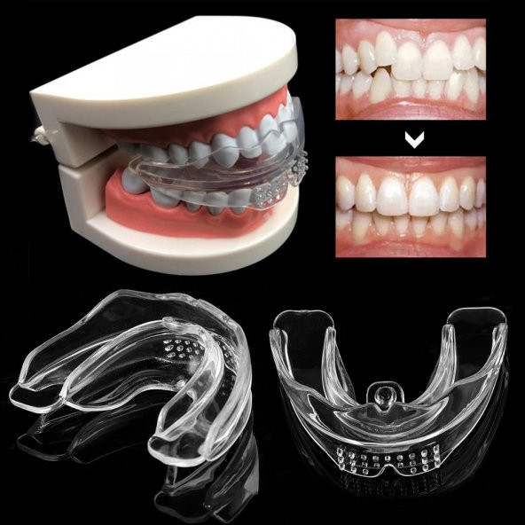 Diş silikon ortodontik parantez SET 3 lü YUMUŞAK ORTA SERT