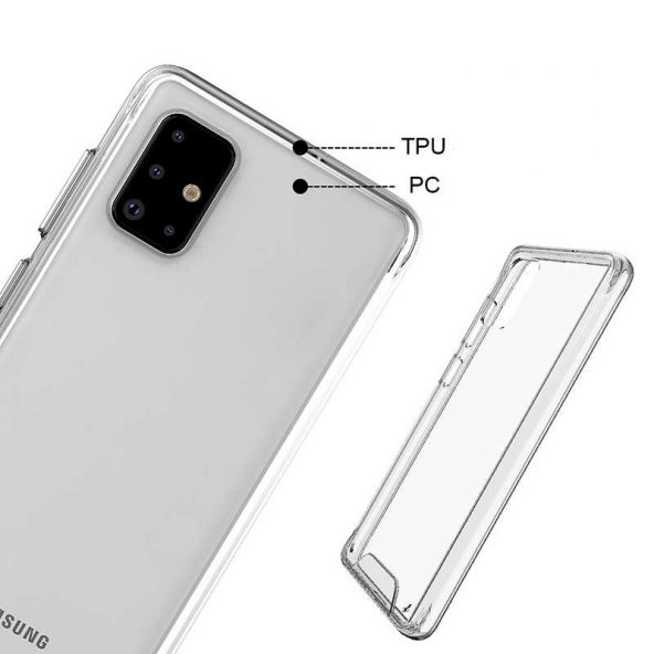 Galaxy A51 Kılıf Zore Gard Silikon - 5