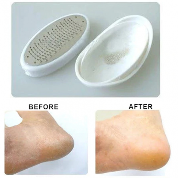 AYAK TOPUK TÖRPÜSÜ AYAK PEELİNGİ TOPUK TEMİZLEYİCİ TÖRPÜ PED EGG - 3