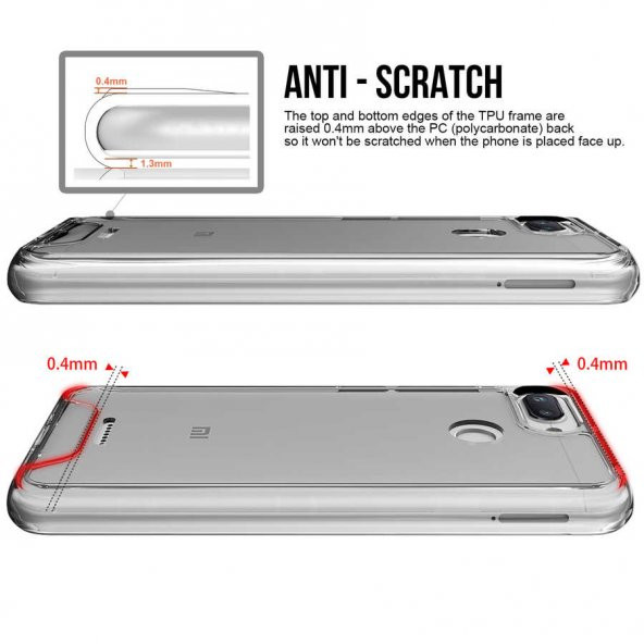 Xiaomi Redmi 6 Kılıf Zore Gard Silikon - 3