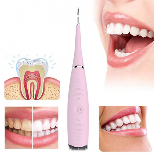 Yüksek Performanslı Titreşimli Yüz Temizleyici Ve Yüz Masaj Aleti Facial Brush 2 İn 1 (pembe) - 2
