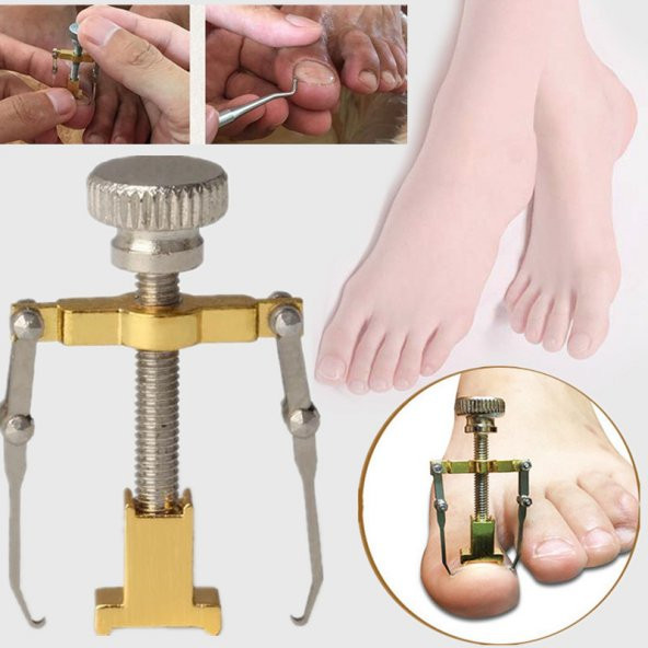 Paslanmaz Çelik Batık Tırnak Çıkartma Aparatı - 3