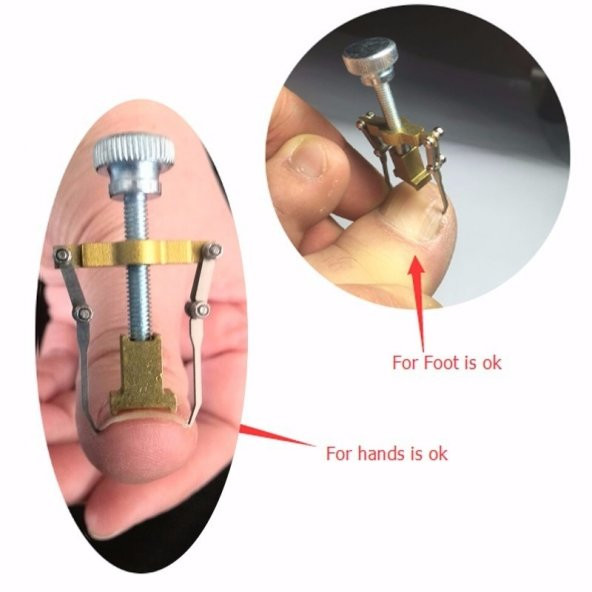 Paslanmaz Çelik Batık Tırnak Çıkartma Aparatı - 5
