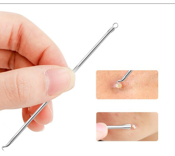 4 Parça Kutulu Paslanmaz Çelik Sivilce Akne Siyah Nokta Komedon - 7