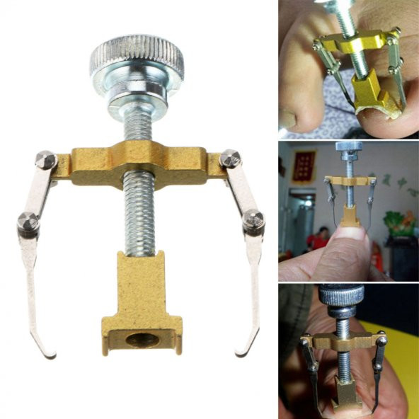 Paslanmaz Çelik Batık Tırnak Çıkartma Aparat - 5