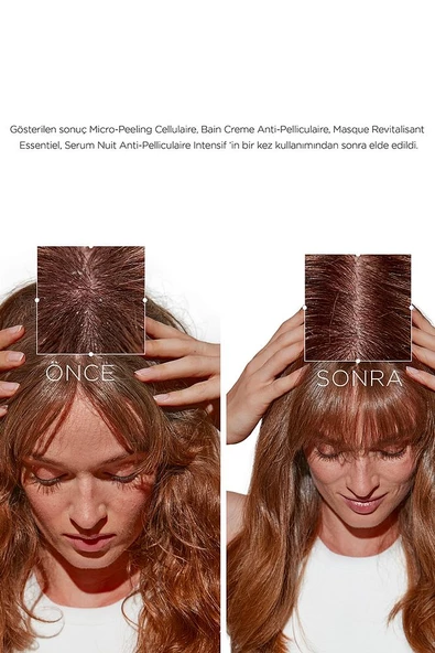 Kerastase Symbiose Kepek Karşıtı Yatıştırıcı Saç Kremi 200 ml - Resim 4