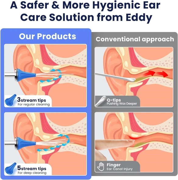 Auracle Kulak Kiri Temizleme - 4 Su Basınç Modu Kulak Temizleyici - Mavi - 3
