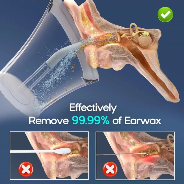 Morfone Elektrikli Etkili ve Güvenli Kulak Temizleme Kiti - Gri - 2