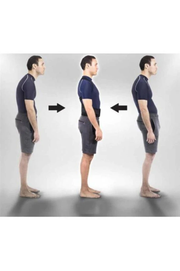 Manyetik Dik Duruş Kamburluk Önleyici Kadın Erkek Kifoz Skolyoz Korsesi Düz Duruş Korse Dik - Resim 4